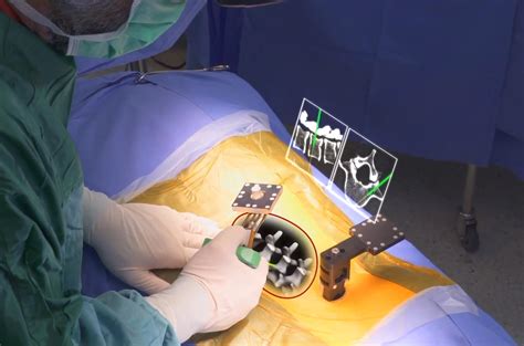 Today 3 Startups Using Augmented Reality In Surgery