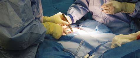 Colon Cancer Section Of Colon And Rectal Surgery Washington