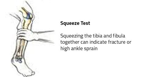 Guide For Speed Up High Ankle Sprain Recovery Time Your Health Guidelines