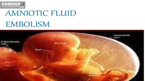 Amniotic Fluid Obstetrics Bsc Nursing Youtube