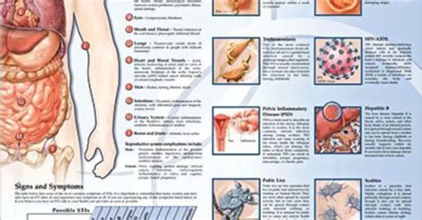 Sexually Transmitted Infections Anatomy Poster Anatomy Bodies And