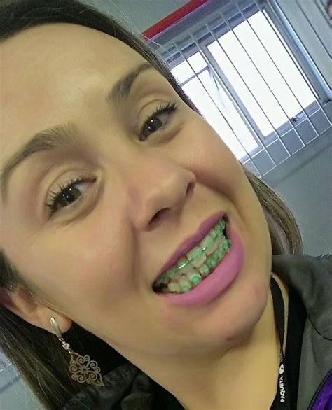 Pin By John Beeson On Girls In Braces In Nose Ring Septum Ring
