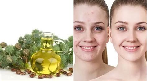 How To Use Castor Oil To Get Rid Of Oil Clogs And Age Spots Skin Age