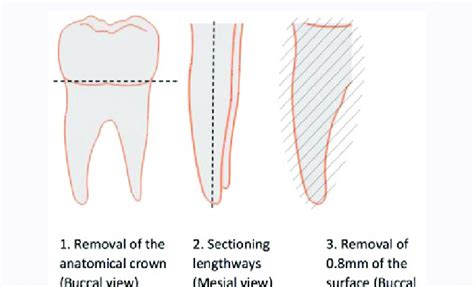 Sectioning Of Tooth Samples Download Scientific Diagram