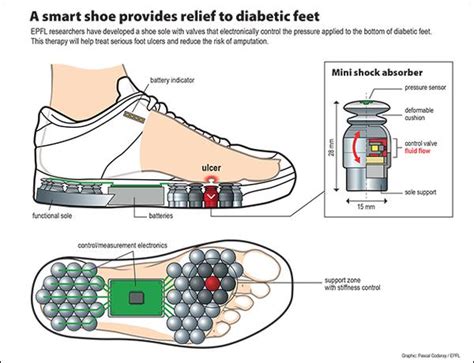 Diabetes A Smart Shoe To Help Reduce Amputations Epfl