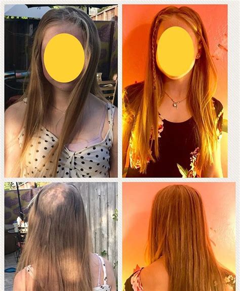 Pulling Hair Out Habit 2020 Hair Ideas And Haircuts For Women Good Housekeeping
