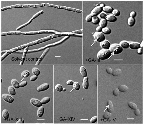 Inhibition Of C Albicans Yeast To Hypha Transition By Individual Gas