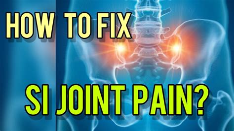 How To Fix Sacroiliac Joint Pain Top Si Joint Pain Stretches