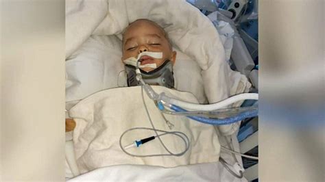 Gofundme Account Set Up For Texas Toddler Facing Multiple Surgeries