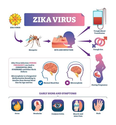 Premium Vector Zika Virus Vector Illustration Labeled Mosquito Bite Infection Signs And