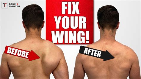 Fix Scapular Winging With Shoulder Blade Exercises Youtube