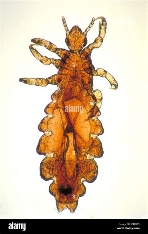 This Image Depicts A Dorsal View Of A Female Head Louse Pediculus
