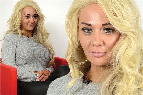 Josie Cunningham Sparks Anger As She Accepts Nhs Nose Job But Is It
