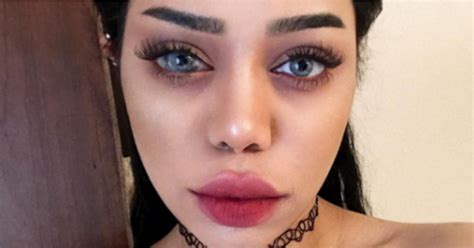 Beauty Vlogger Sonia Leslies Eye Birthmark Popsugar Beauty