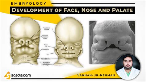 Development Of Face Nose And Palate Embryology Lectures Medical