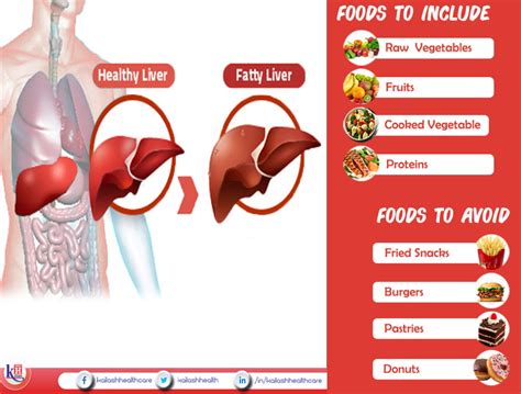 Fatty Liver Diet Foods To Include And Avoid