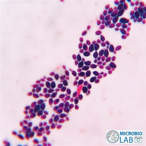 Microbiologylab On Instagram Yeast Cells By Gram Staining