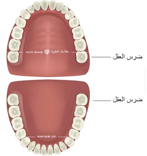 كيف اعرف ضرس العقل