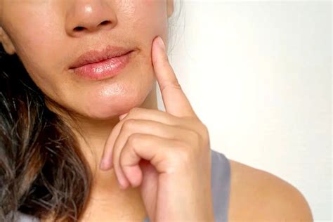 Dry Lips Causes And Doctor Approved Remedies You Can Use