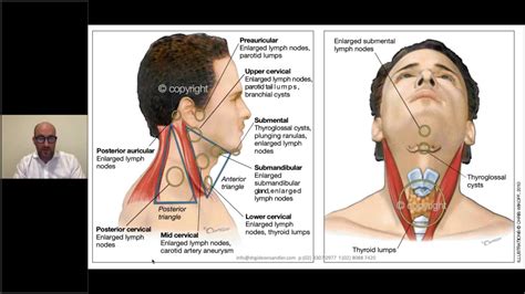 Neck Lumps In General Practice Theme Hill