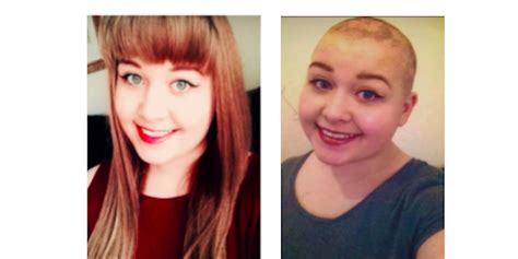 Trichotillomania And Choosing To Shave My Head