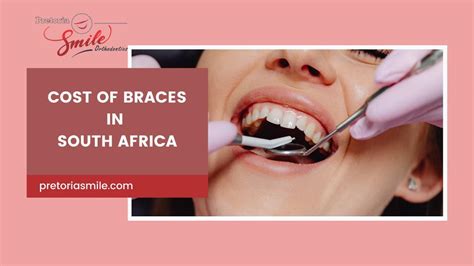 2024 Cost Of Braces In South Africa Pretoriasmile Orthodontics