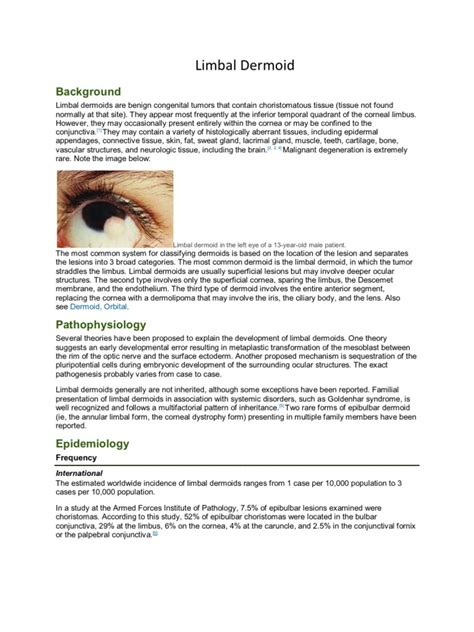 Limbal Dermoid Cornea Human Eye