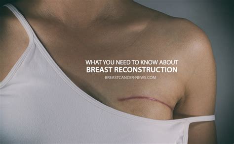 Breast Reconstruction Pictures