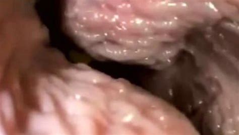 Sex And Orgasm From Inside The Vagina Fetish Porn At Thisvid Tube