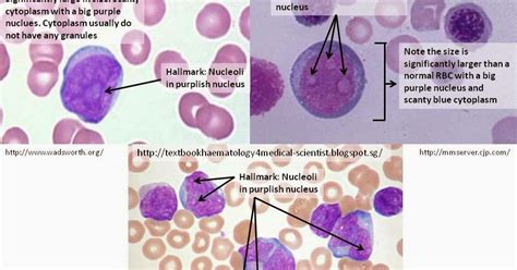 Haematology In A Nutshell Immature Granulocytes In Pbfs