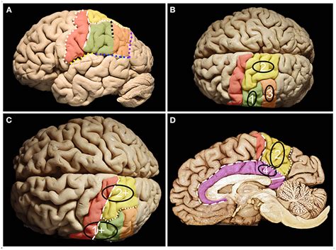 Frontiers Cortical And Subcortical Anatomy Of The Parietal Lobe From