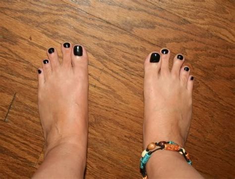 2nd and 3rd toes separate toes health orthopedics