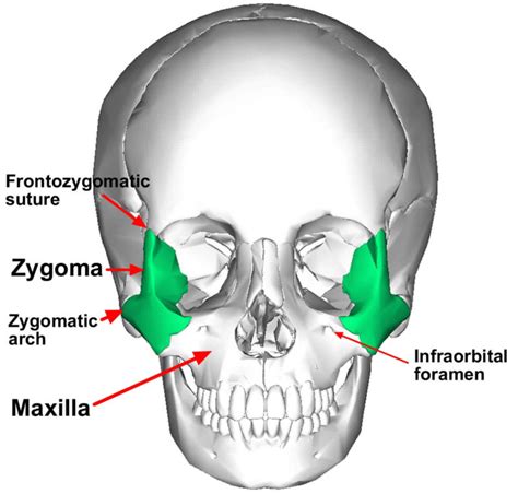 Zygoma Anatomy Zygoma Fracture And Zygoma Surgery
