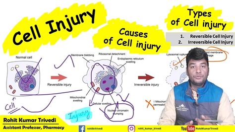 Cell Injury Pathology Types Etiology Pathophysiology Youtube