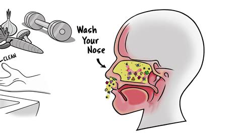 A Medical Breakthrough Wash Your Nose Youtube