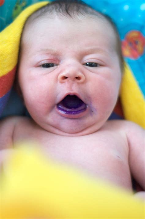 Gentian Violet Deep Purple Dye Kills Some Cancer Cells Early Research