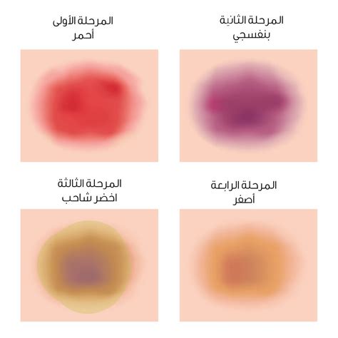 ظهور خط خفيف جدا في اختبار الحمل بعد ساعات في اختبار الحمل المنزلي قبل موعد الدورة. في اليوم الأول تقوم الصفائح الدموية بإغلاق ثقوب الأوعية ...