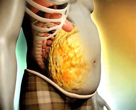 3 Lesser Known Conditions That May Be Caused By Belly Fat — Lumen