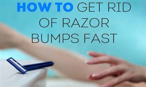 6 Home Remedies To Get Rid Of Razor Bumps Fast Skin Beauty