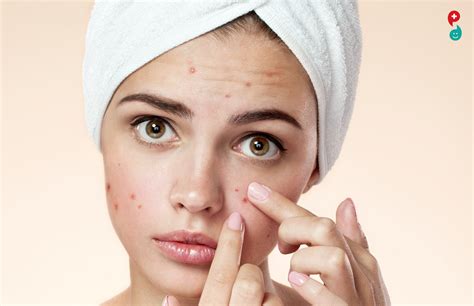 Hard Pimples Causes Treatment And More