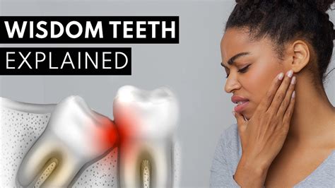 Wisdom Teeth Explained Pain Symptoms And Extractions Youtube