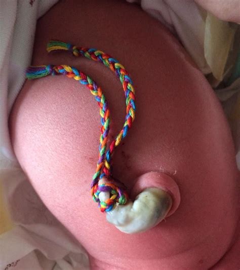 Rainbow Cord Tie Cord Clamping Cord Ties Unassisted Homebirth