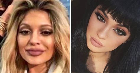 Kylie Jenner Praises Plastic Surgeon Responsible For That Trout Pout