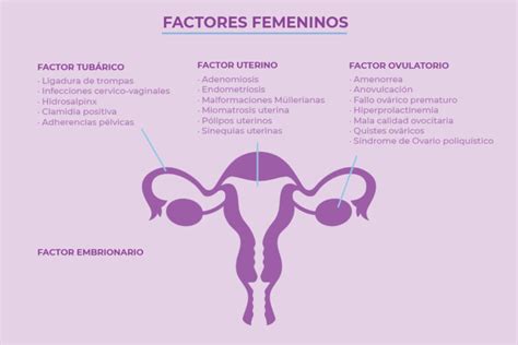 Principales Causas De Infertilidad Femenina Crea Cl Nica De