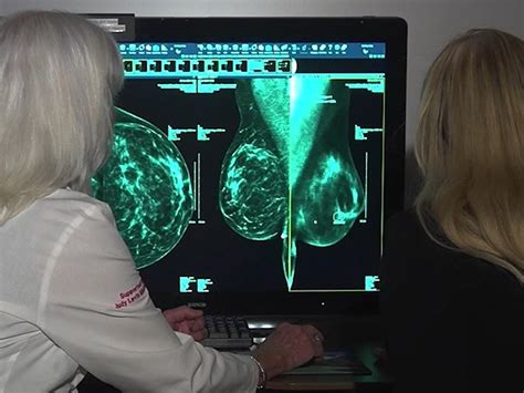 Updated Recommendations For Breast Cancer Screening Women Should Get Regular Mammograms At Age 40
