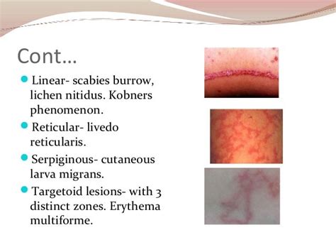 Reticular Skin Lesions
