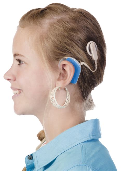 Cochlear Implant Research