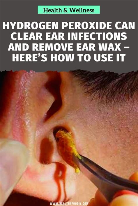 Hydrogen Peroxide Can Clear Ear Infections And Remove Ear Wax Heres