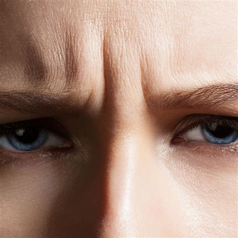 Types Of Wrinkles Newbeauty