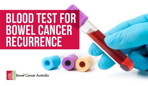 Bowel Cancer Blood Testdna Stool Test Bowel Cancer Australia